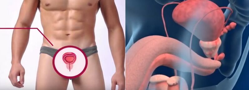 Prostatitis in men, recognizable by some signs